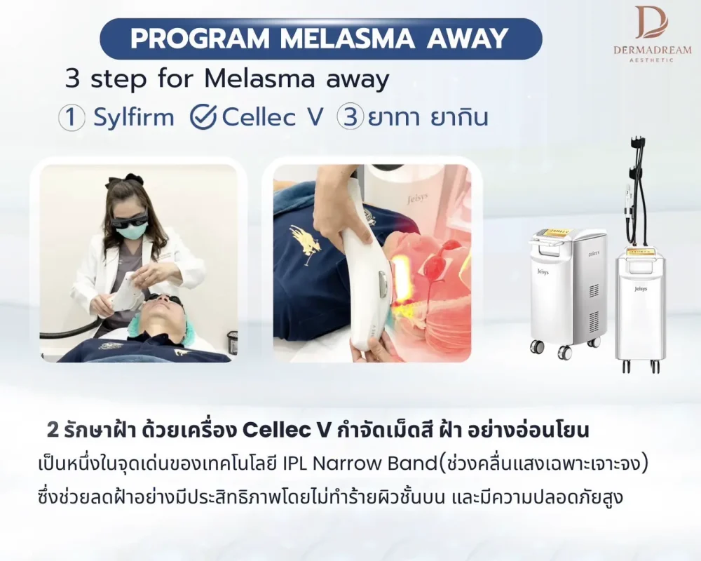 รักษาฝ้า อโศก